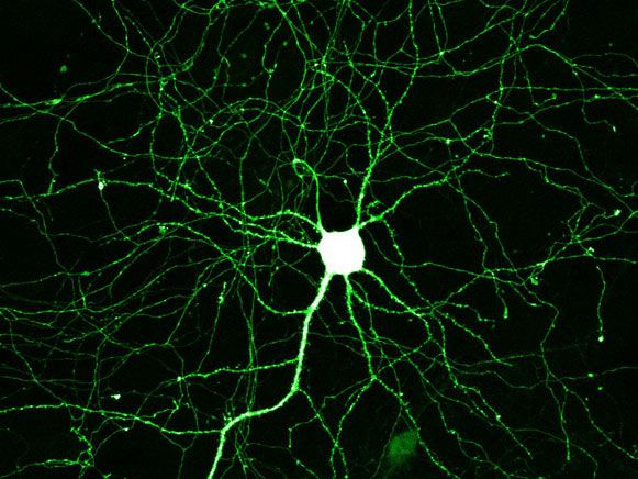 wpid-12277_neuroni.jpg