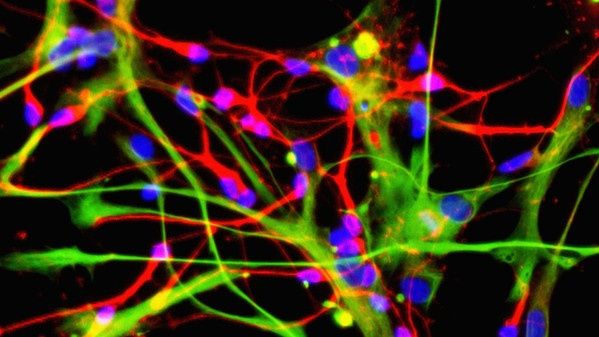 wpid-15239_neuroni.jpg