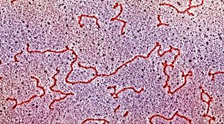 wpid-3662_rna.jpg