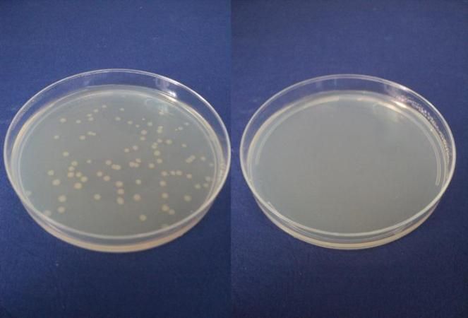 wpid-9123_escherichiacolinuovescopertegiugno.jpg